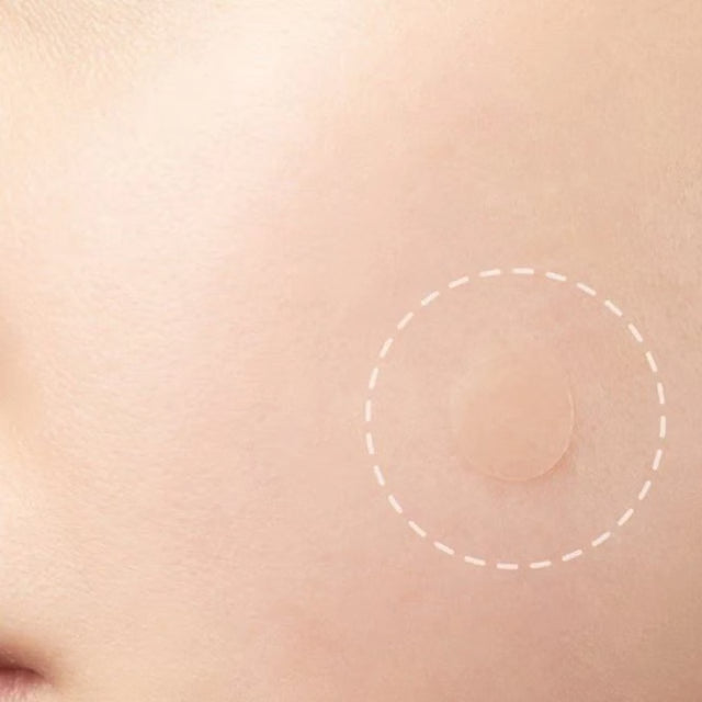 Skin Mole Removal Patch for Easy At Home Skin Tag and Mole Care